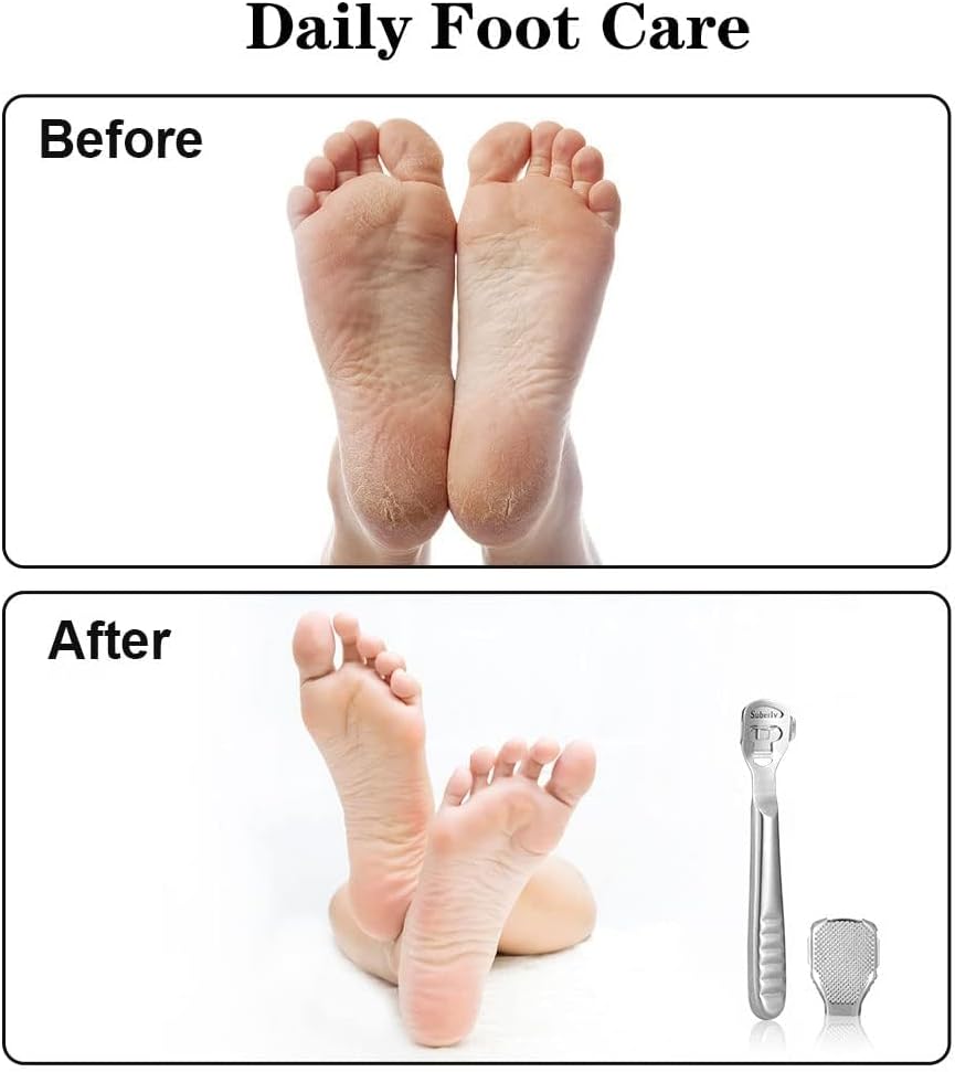 Luxury Foot Callus Remover Set