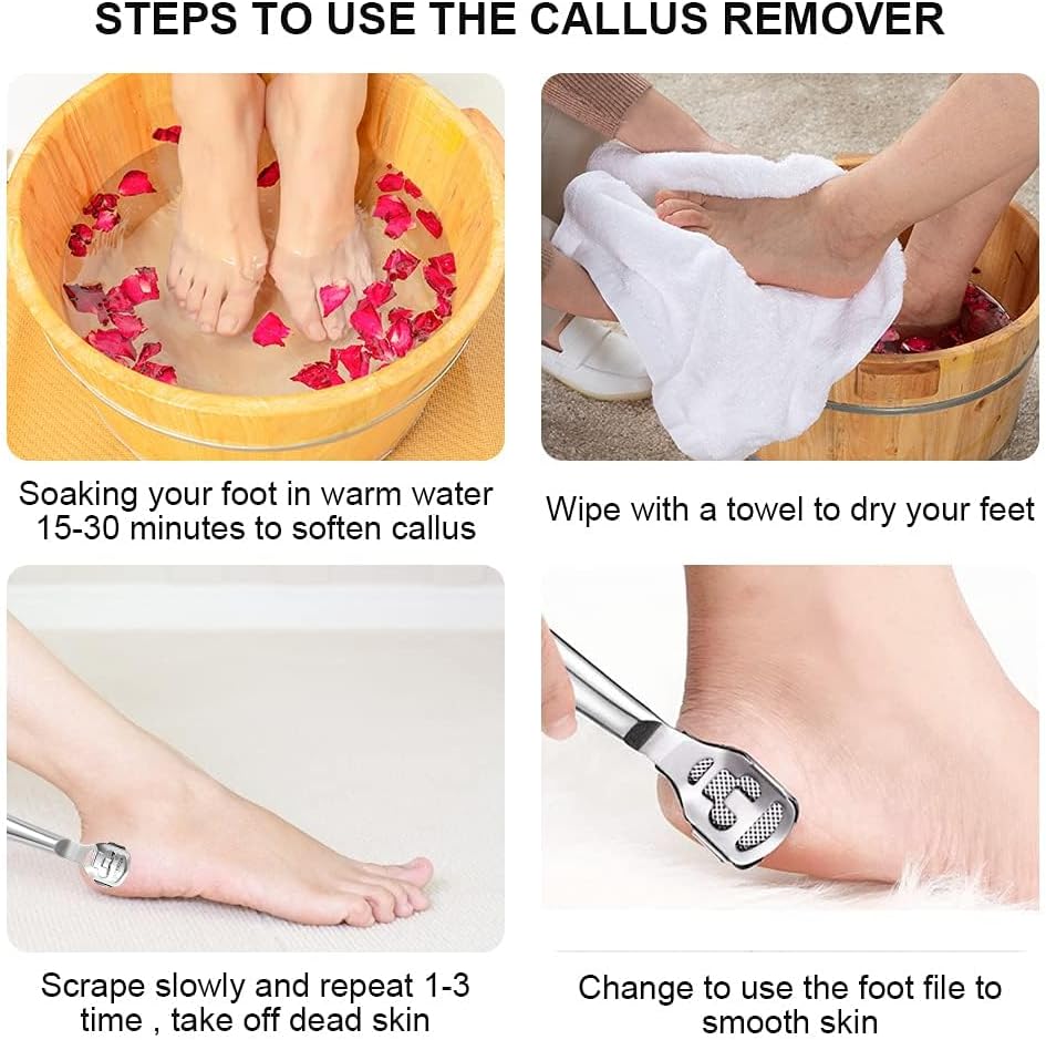 Luxury Foot Callus Remover Set